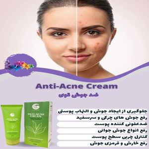 فروش اینترنتی کرم آنتی آکنه