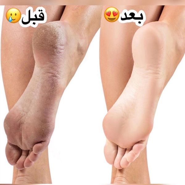 کرم ترک پا و دست رایحه شیر و موز آیچون بیوتی