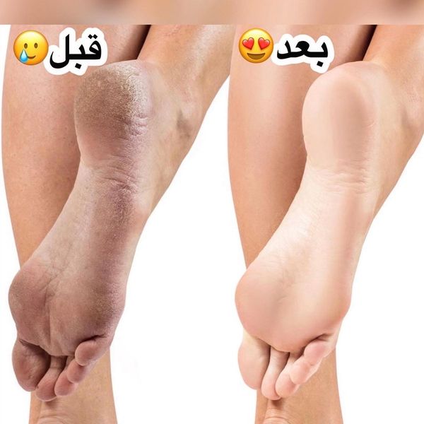 کرم ترک پا و دست برند هدا بیوتی