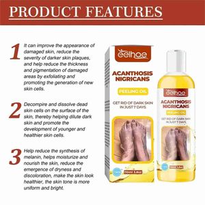 خرید آنلاین روغن لایه‌بردار از بین برنده تیرگی پوست آکانتوز نیگریکانس Acanthosis Nigri