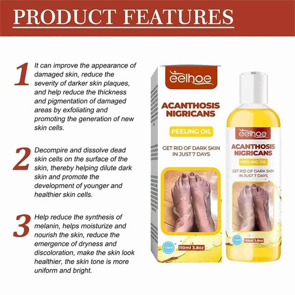 روغن لایه‌بردار از بین برنده تیرگی پوست آکانتوز نیگریکانس Acanthosis Nigri
