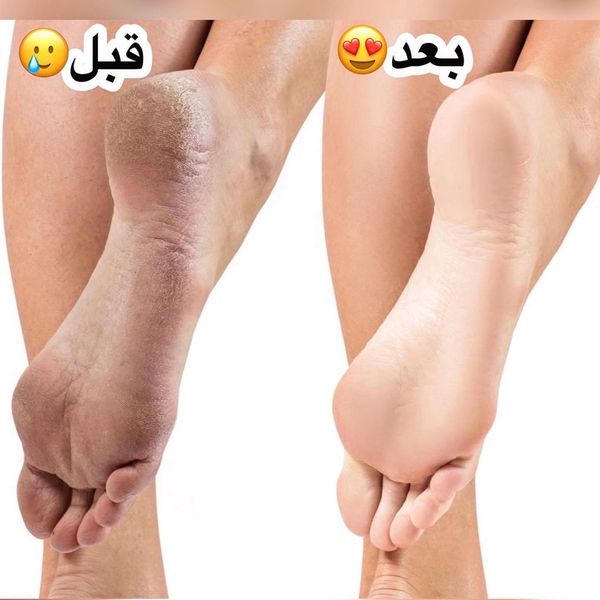 کرم ترک پا و دست برند تاپ لیدی
