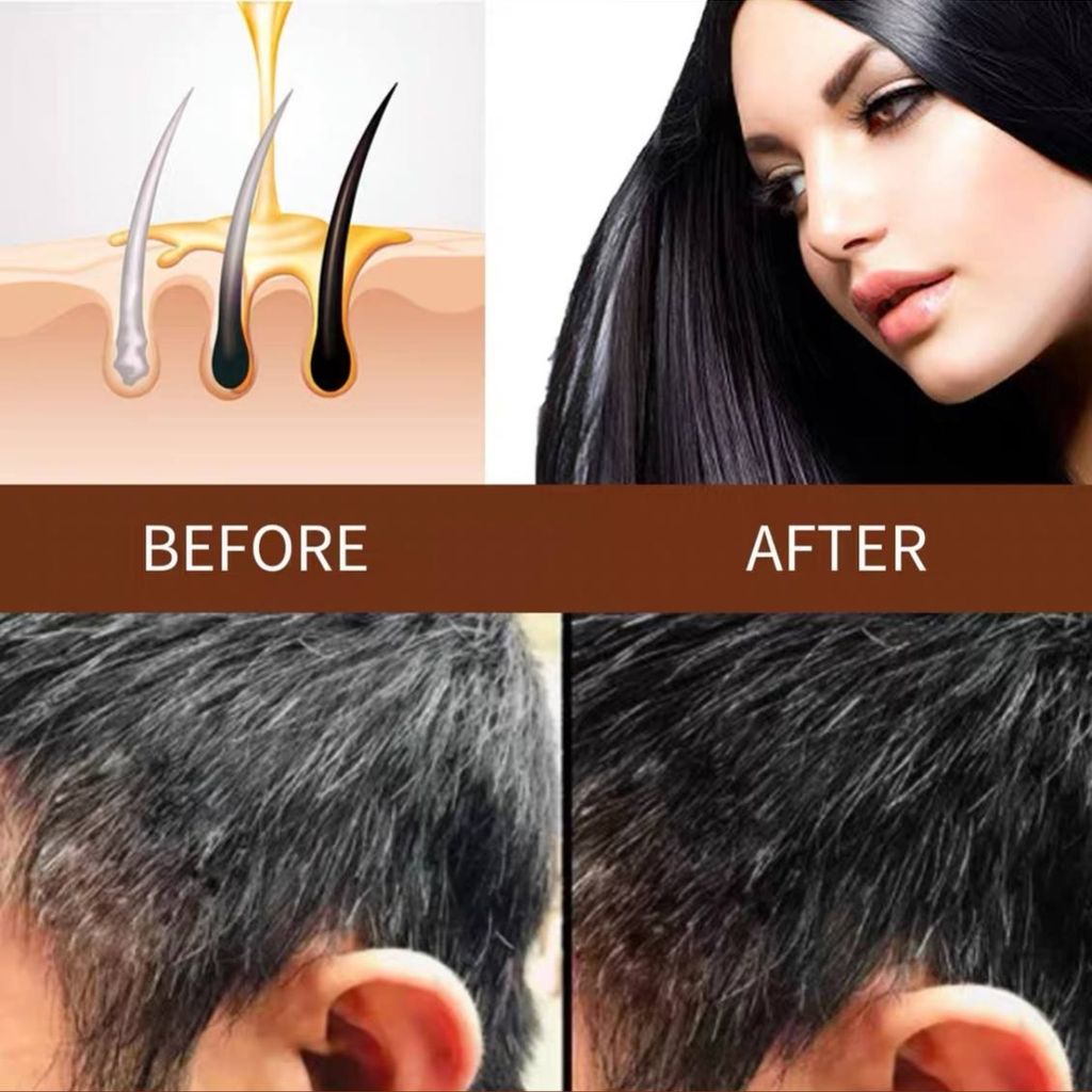 قیمت ارزان صابون گیاهی شامپویی جادویی رفع سفیدی مو دایمی جینسینگ