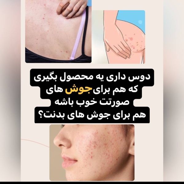 سرم سفید کننده آلفا فوری و قوی بیکینی