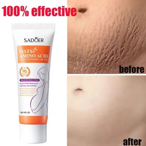 کرم ترمیم کننده استرچ مارک سادور حاوی جو دوسر و آمینو اسید وزن 40 گرم SADO