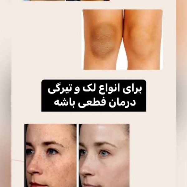 سرم روشن کننده تخصصی بدن AHA اصل