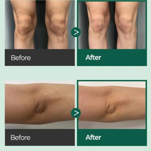 سرم روشن کننده تخصصی بدن AHA اصل